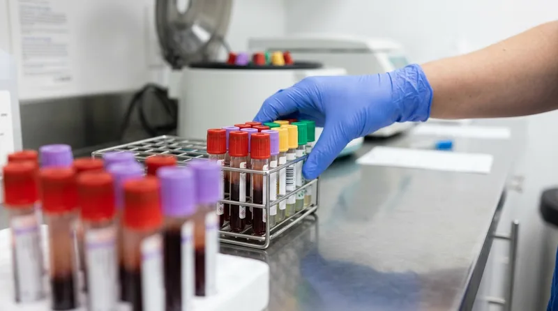 Gloved hand placing blood collection tubes in a rack as a hormone panel is prepared for lab testing