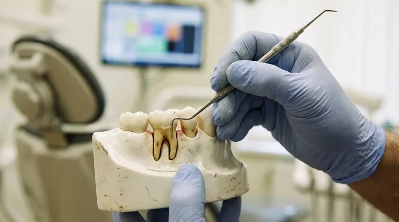 Gloved hand pointing to receded gum margins and exposed roots on a dental anatomy model