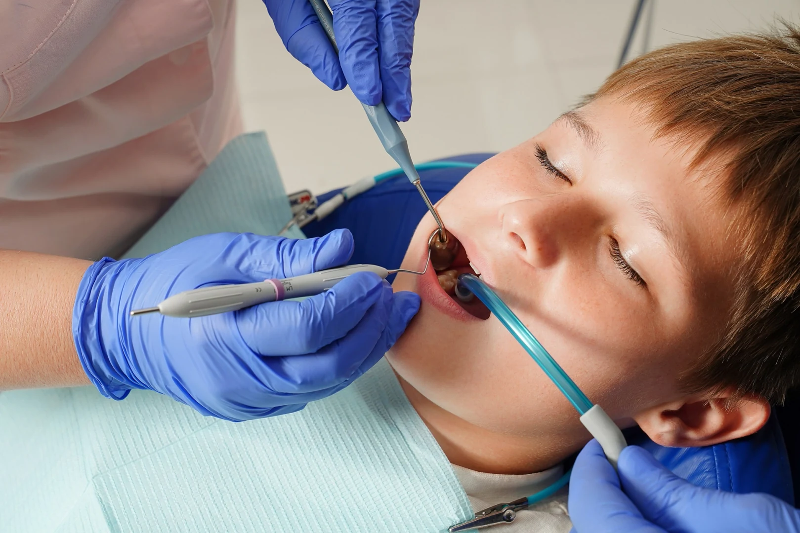 Children's Endodontics