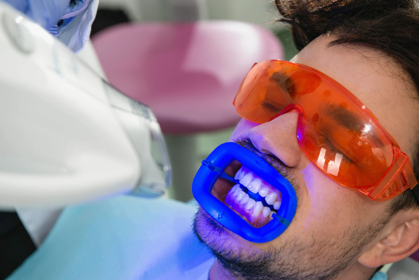 Professional Teeth Whitening