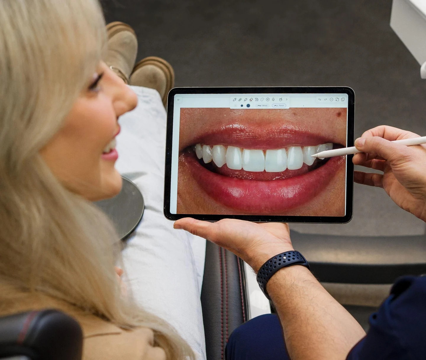 Porcelain Veneers