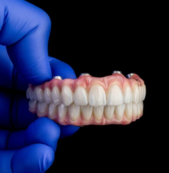 Dental Implants