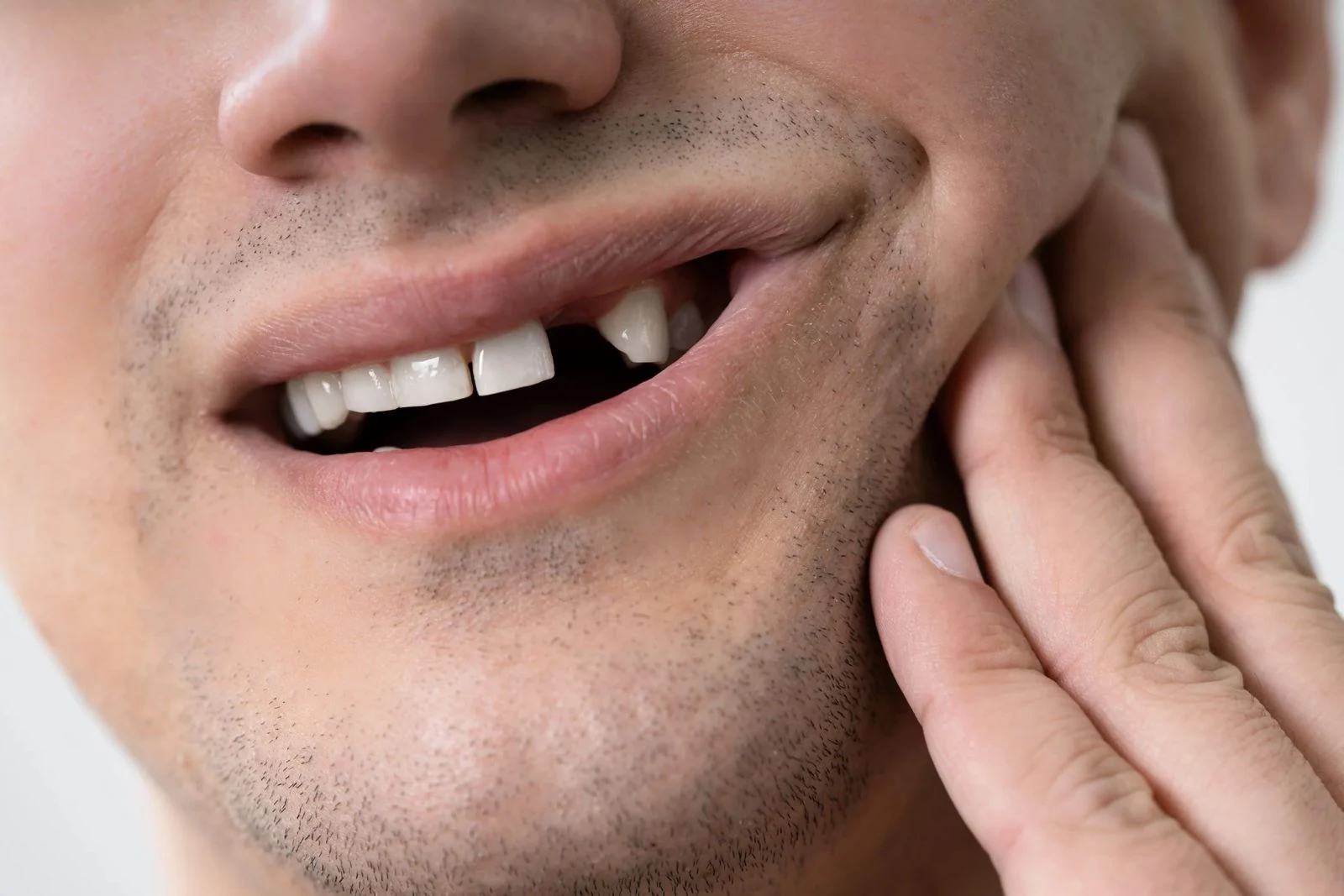 Knocked-Out Tooth