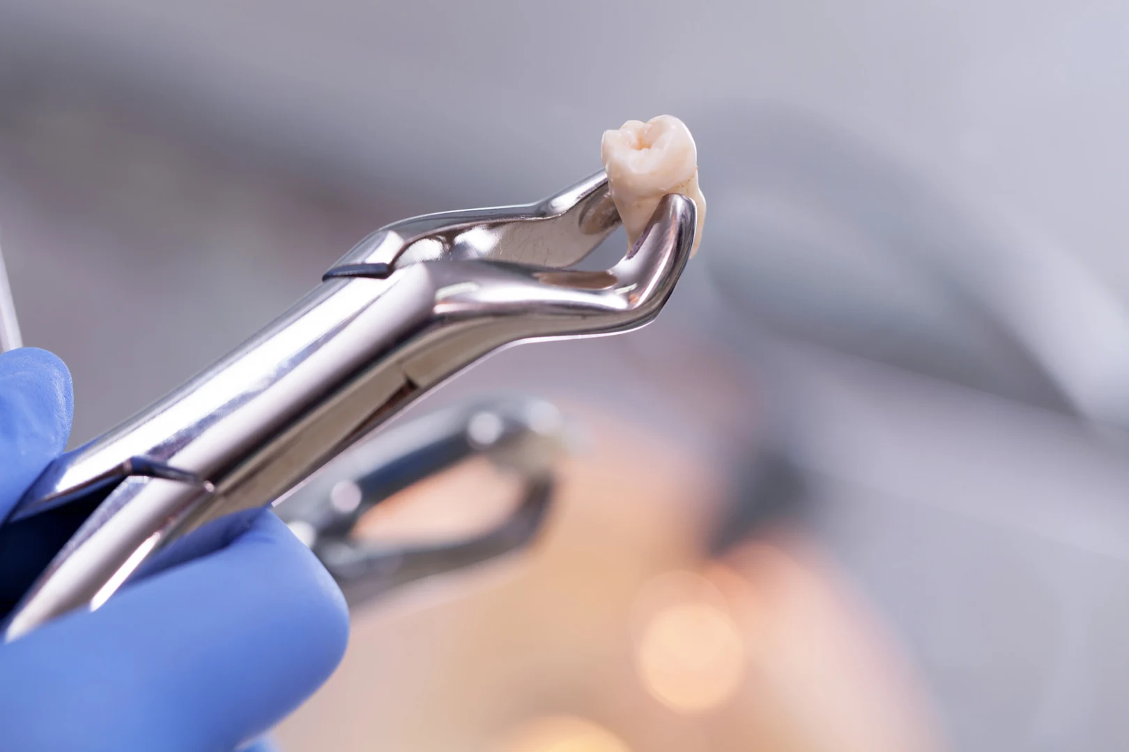 Wisdom Teeth Extraction