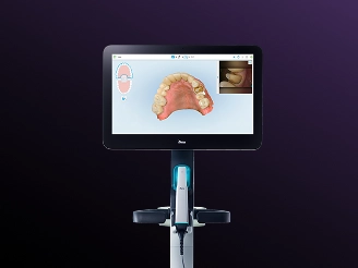 The iTero intraoral scanner and screen used in our office