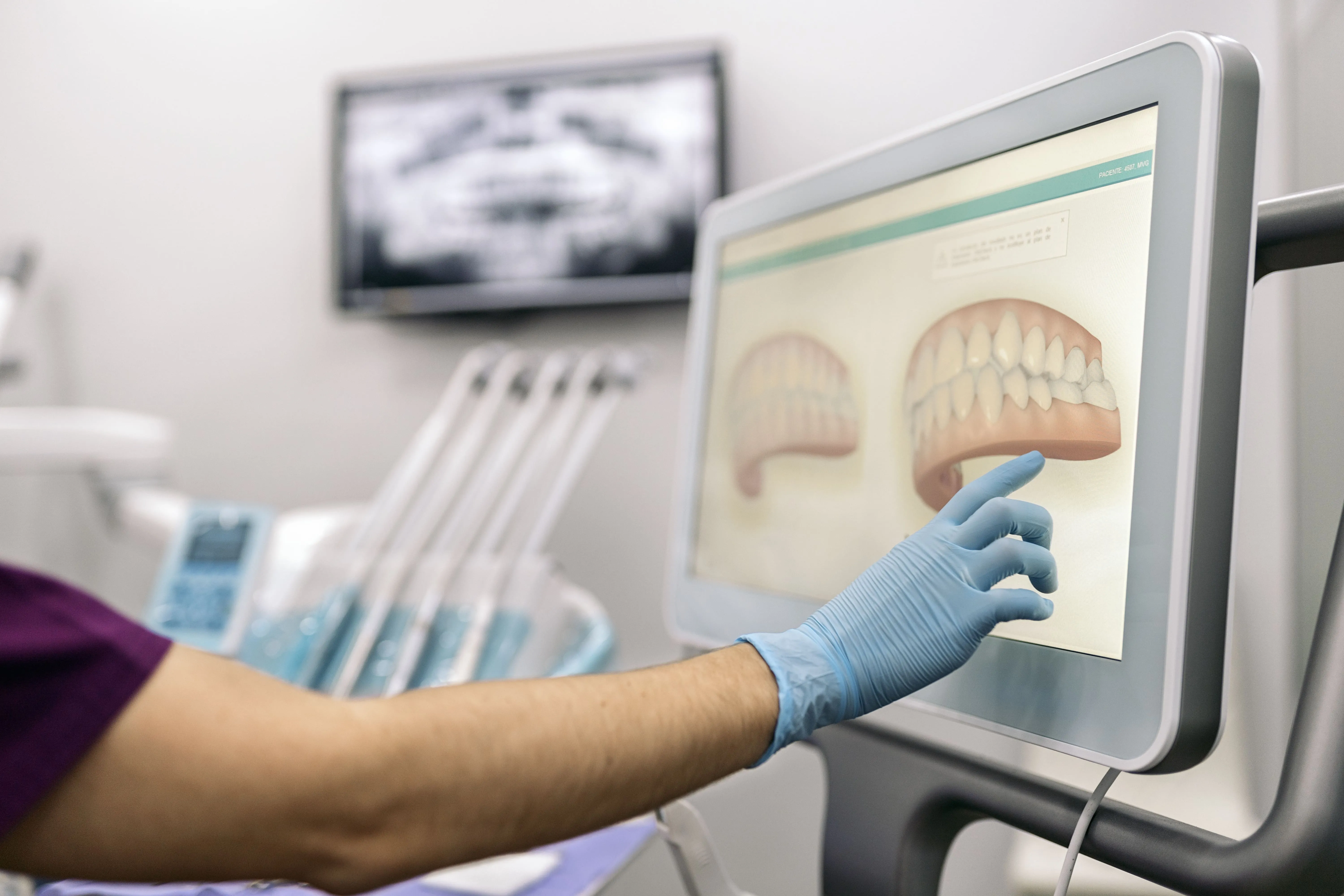 Our dentist pointing to a 3D model of a patient's upper and lower teeth on the chairside screen